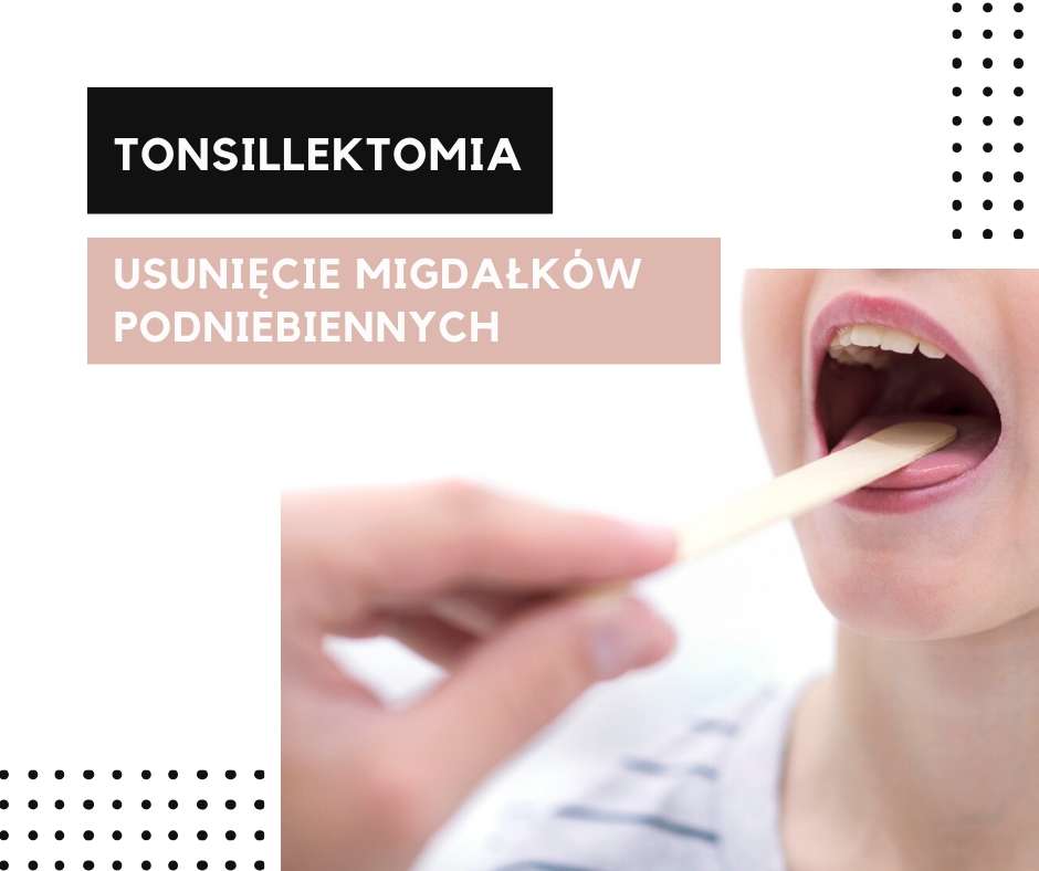tonsillektomia - laryngolog elblag